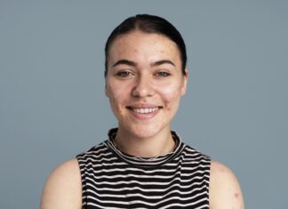 usuwanie blizn potrądzikowych